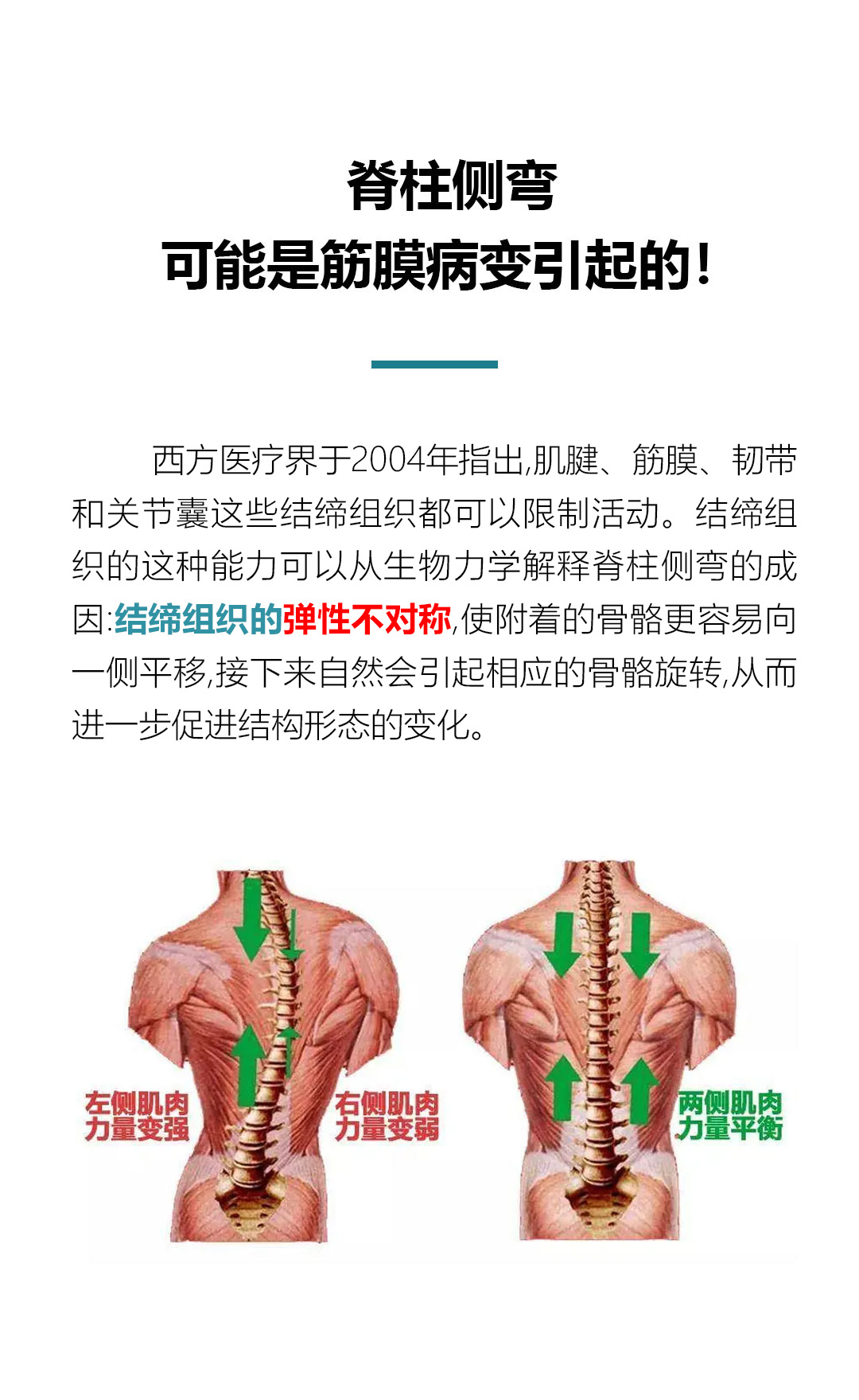 第十三篇推文（脊柱侧弯）_06.jpg